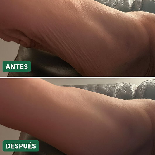 Loción Reparadora y Reafirmante de Piel